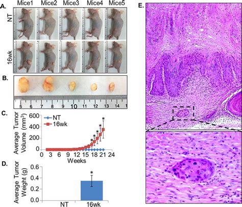 Tumorigenic Competence Of Control And UVB Transformed Cells In Nude