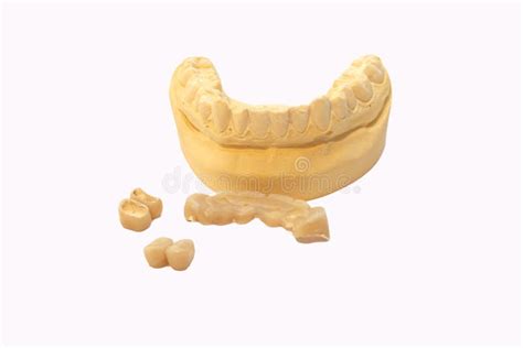 Plaster Impression of the Dental Apparatus- Stock Photo - Image of ...