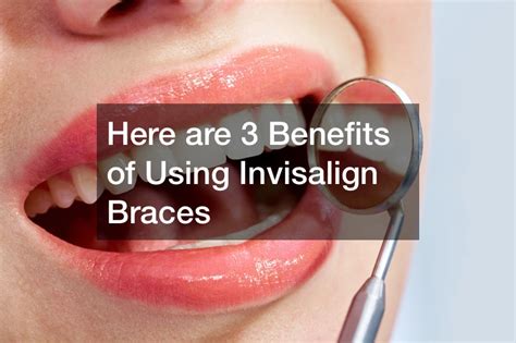 Here Are 3 Benefits Of Using Invisalign Braces Big Dentist Review