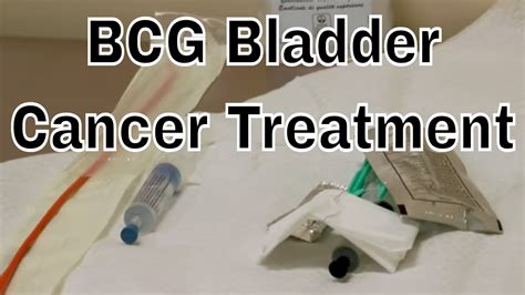 BCG Treatment For Early Bladder Cancer Chemo YouTube