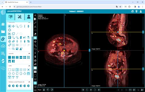 PET CT PET MR Fusion PostDICOM Knowledge Base