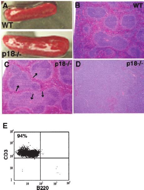 Lymphoproliferative Disorder And T Cell Lymphomas In P18 Mice A