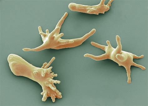 Amoeba protozoa, SEM Photograph by Science Photo Library - Pixels