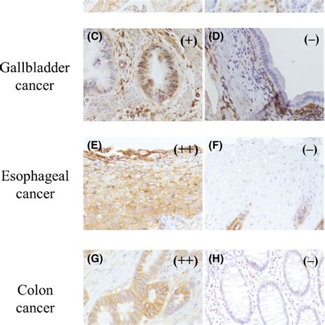 Representative Images Of Human Lymphocyte Antigen Hla Class I