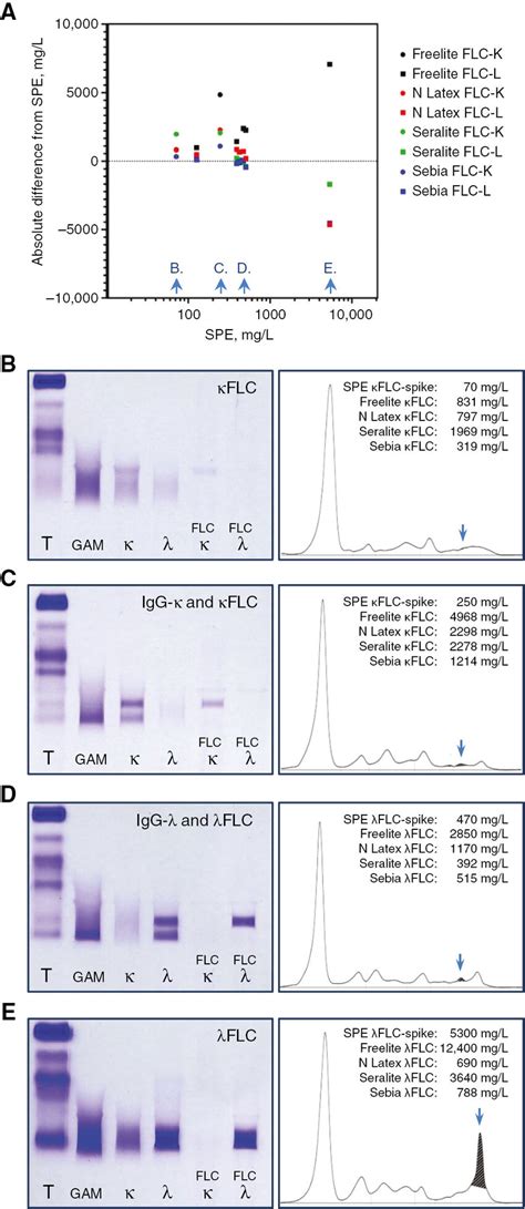 Method Comparison To Electrophoresis A Quantification Of Eight