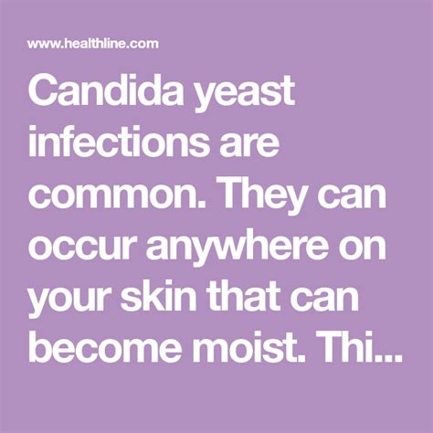 Scalp yeast infection symptoms causes and treatments – Artofit