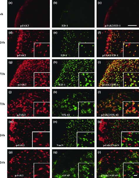 Activated Microglial And Macrophages Are The Major Cell Type That