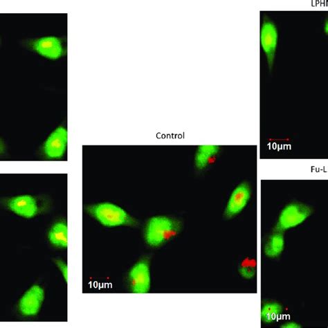 Lysosomal Membrane Integrity And Permeability Was Assessed By Acridine