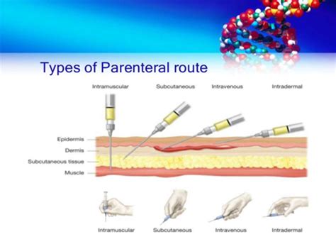 QUIZ 2 Parenteral Injections Subcutaneous Intramuscular Intradermal