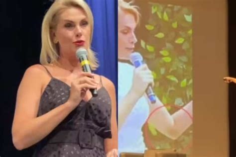 Ana Hickmann Se Emociona Ao Mostrar Hematomas De Agressão Pela Primeira Vez