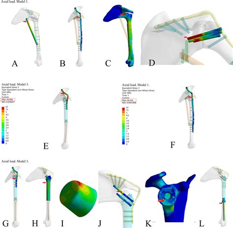 Frontiers Design And Validation Of A Novel 3D Printed Glenohumeral