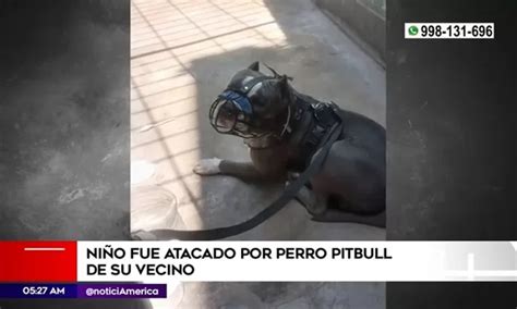 El Agustino Niño quedó grave tras ser atacado por perro pitbull de su