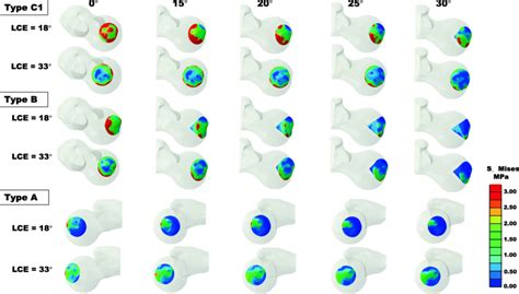 Top View Of The Von Mises Stress Distribution Of Types A B And C In