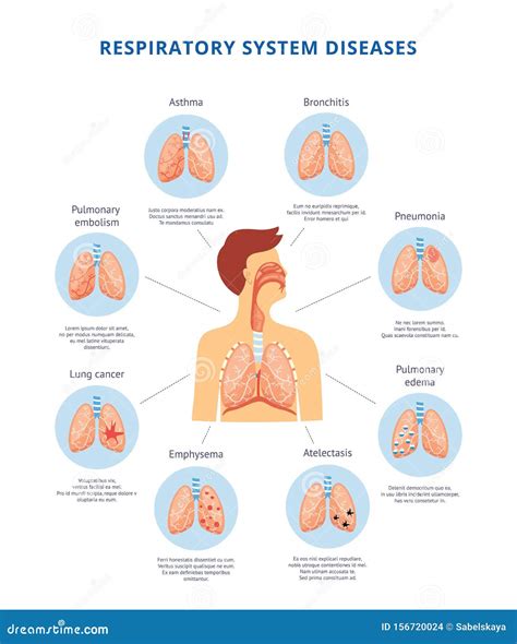 Human Respiratory System Diseases Informative Diagram Vector Illustration. Stock Vector ...