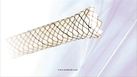 Endoscopy Bougie Dilator Manufacturer/Distributor in India- Medorah.com