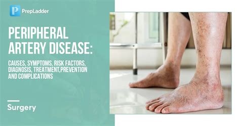 Peripheral Artery Disease Causes Symptoms Risk Factors Diagnosis