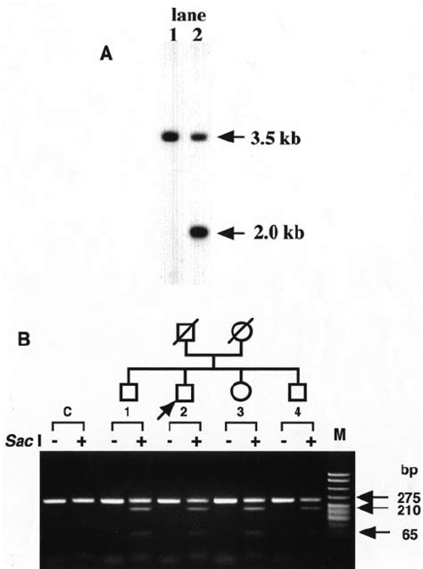 A Southern Blotting Analysis Of The Genomic Dna Digested By Download