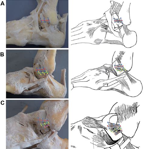 Figure From Anatomic Measurement And Variability Analysis Of The