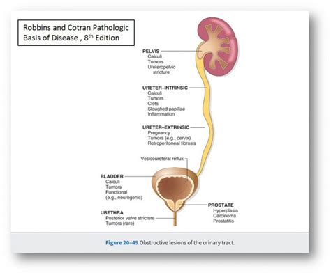 Iii Lower Urinary Tract And Male Genital System Nus Pathweb Nus