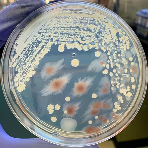 Anton Van Microbiology On Instagram Bacillus Cereus B Subtilis