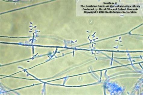 Trichophyton rubrum | Medical laboratory science, Medical laboratory scientist, Microbiology