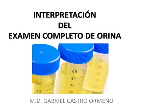 Examen De Orina Completo