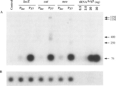 A Autoradiogram Of A Northern Blot Showing The Probing Of Total Rna