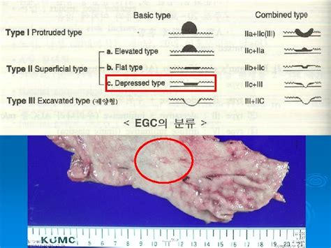 Patient Identification Name 0 0 Sex Male Age