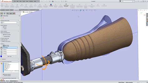 Using SOLIDWORKS 3D Scanning For Prosthetics Design YouTube