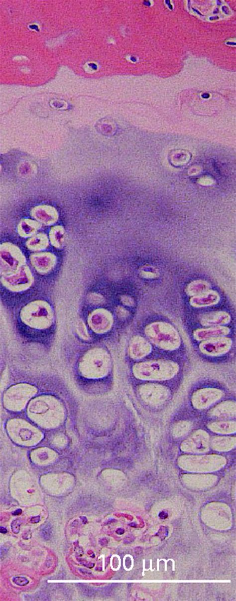 The Role Of Sex Hormones In The Kinetics Of Chondrocytes In The Growth