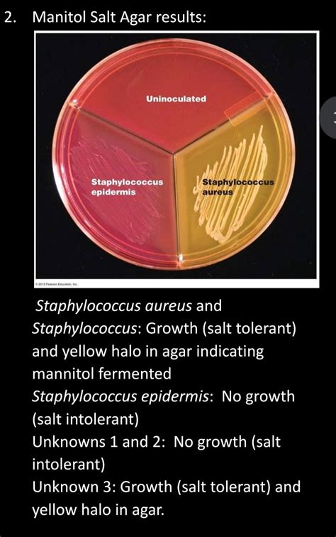 Solved 2. Manitol Salt Agar results: Uninoculated | Chegg.com