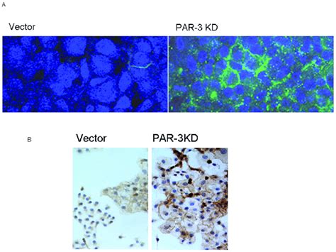 A Chd1 And Beta Catenin Expression In Vector Control And Par 3 Kd Download Scientific Diagram