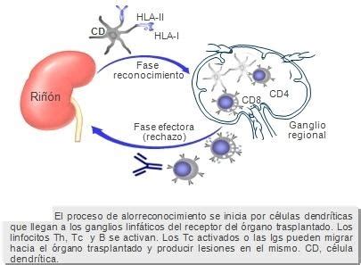 Trasplante De Rganos Rechazo De Un Rgano