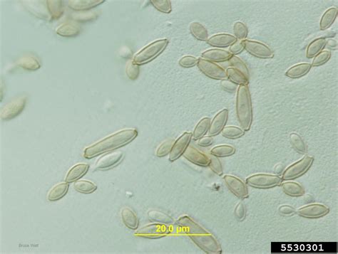 Cladosporium Fungi Genus Cladosporium