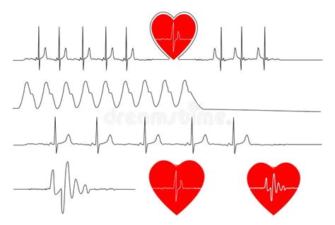 Illustraties Van Hartslag Pulse Electrocardiogram Vector Illustratie