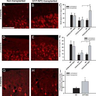 Neuronal Cell Loss In The Superficial Cerebral Cortex Of Mice