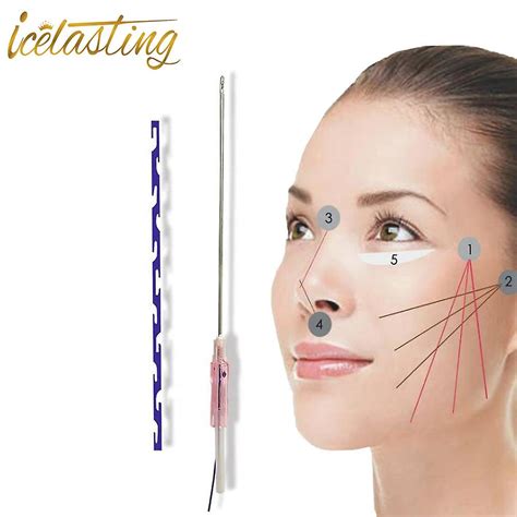 Popular Brand Pdo Thread Lift Supplier Eye Bag Wrinkle Crows Feet