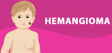 Hemangioma – Causes, Symptoms, Diagnosis, And Treatment – HealthInfoNetwork