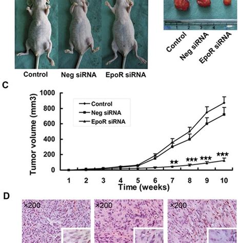 Knockdown Epor Suppresses Tumor Growth In Nude Mice Nude Mice