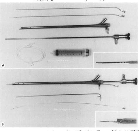 Figure From Rigid Transbronchial Needle Aspiration Biopsy For