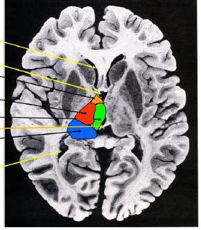 Neuroanatomy Test Degen Regen Thalamus Hypothalamus Flashcards