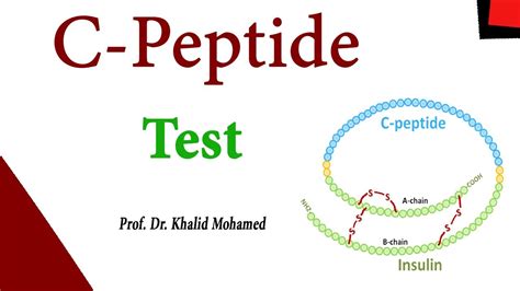 C Peptide Test Vs Insulin Test Youtube