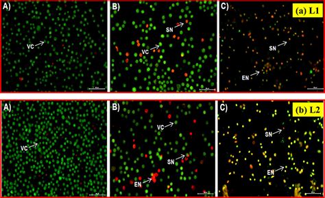 Comparative In Vitro Anticancer Study Of Cisplatin Drug With Green