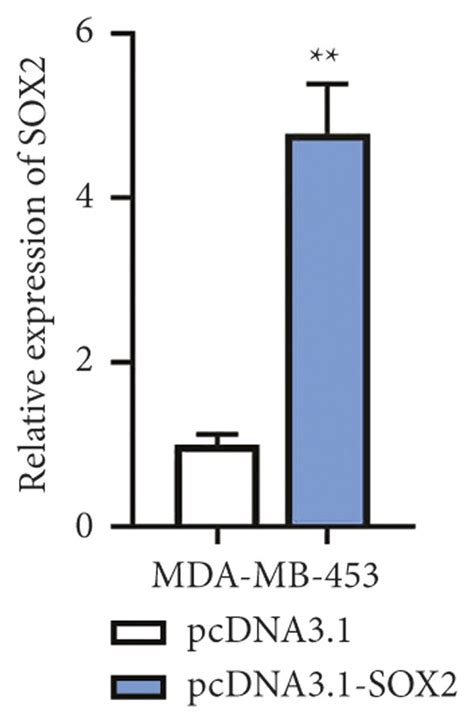 Lucat Contributes To Cell Stemness In Tnbc Via Enhancing Sox