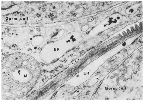 Electron Micrograph Of A Tight Junction Between Adjoining Sertoli Cells