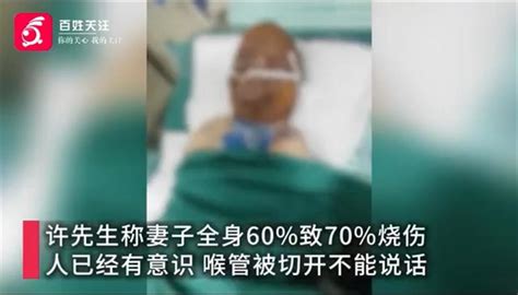 烧伤妈妈获上百万元捐款丈夫呼吁网友别再捐了 腾讯新闻