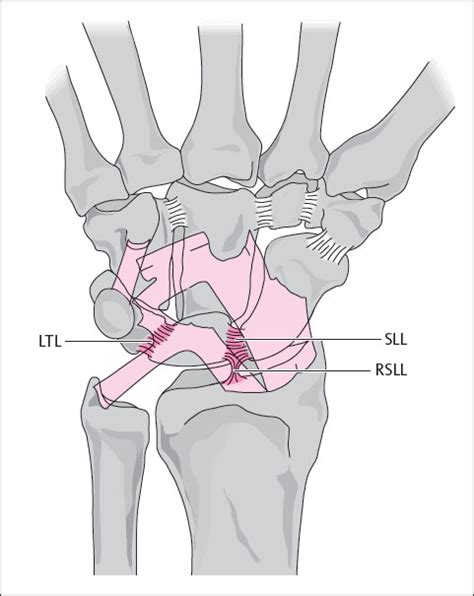 10 Carpal Ligaments | Radiology Key