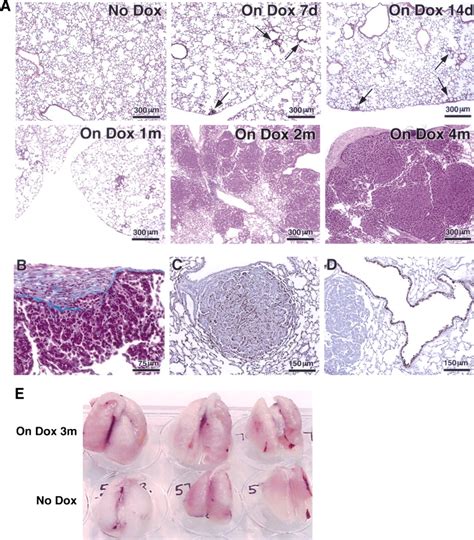 Induction And Apoptotic Regression Of Lung Adenocarcinomas By Regulation Of A K Ras Transgene In