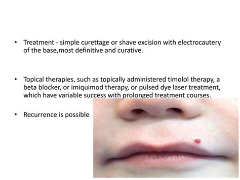 Vascular Anomalies Of Newbornapproach To Infantile Hemangioma Ppt