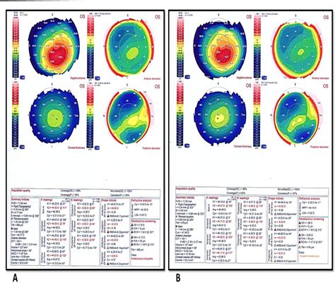 Figure 1 From Safety And Efficacy Of Conventional Versus Accelerated